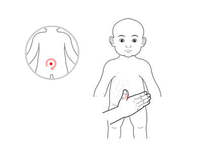 小兒推拿治療感冒嗎？